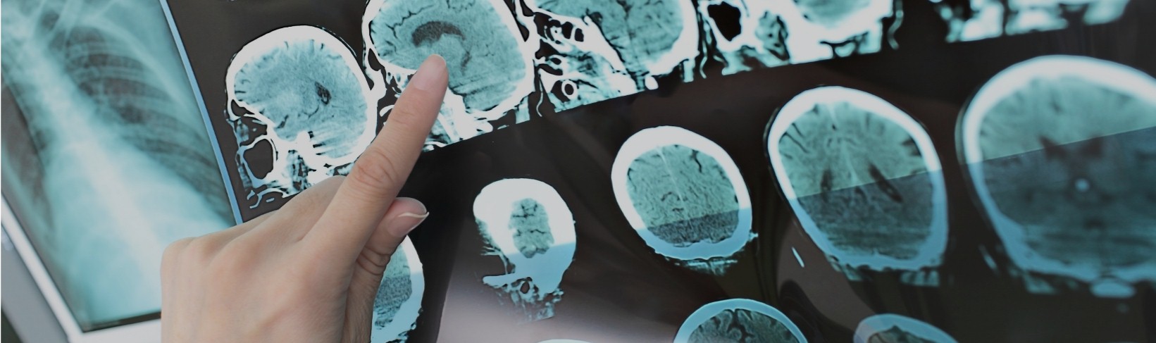Imaging showing brain activity.