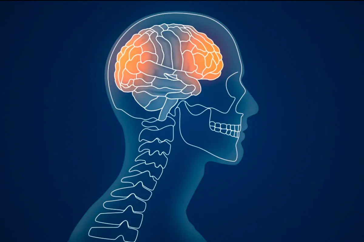 An illustrated x-ray of a brain with two areas lit.
