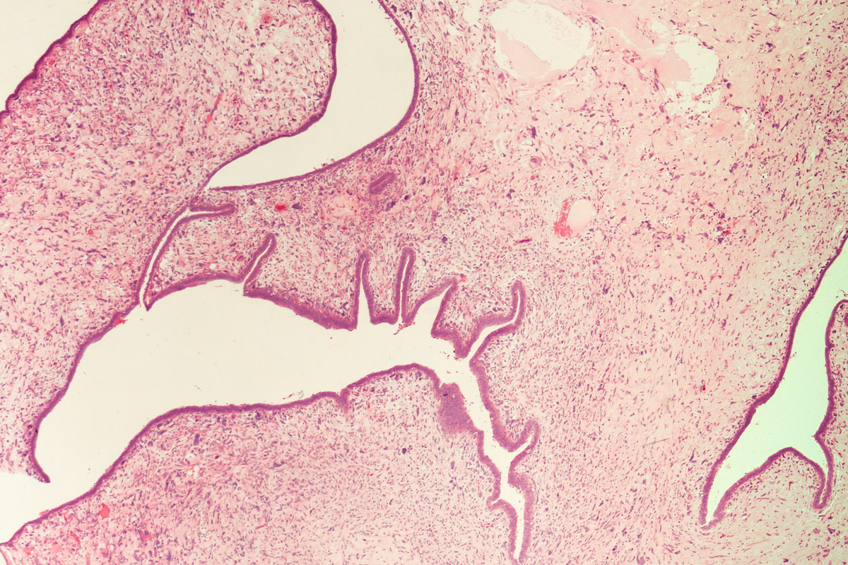 A slide of breast tissue.