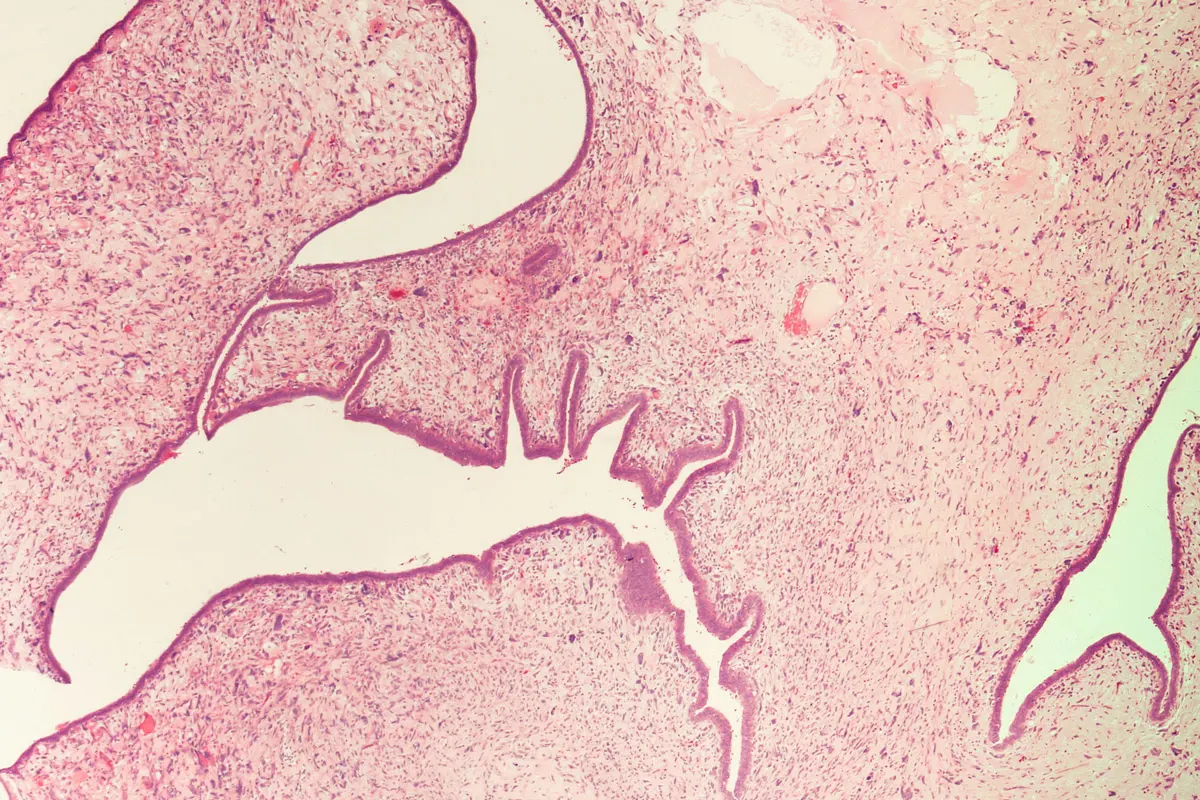A slide of breast tissue.