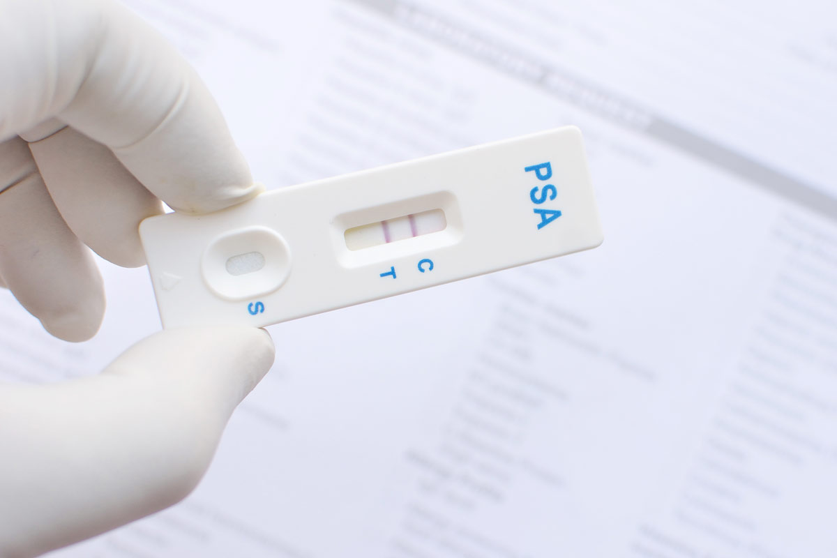 A doctor examining a prostate cancer screen.