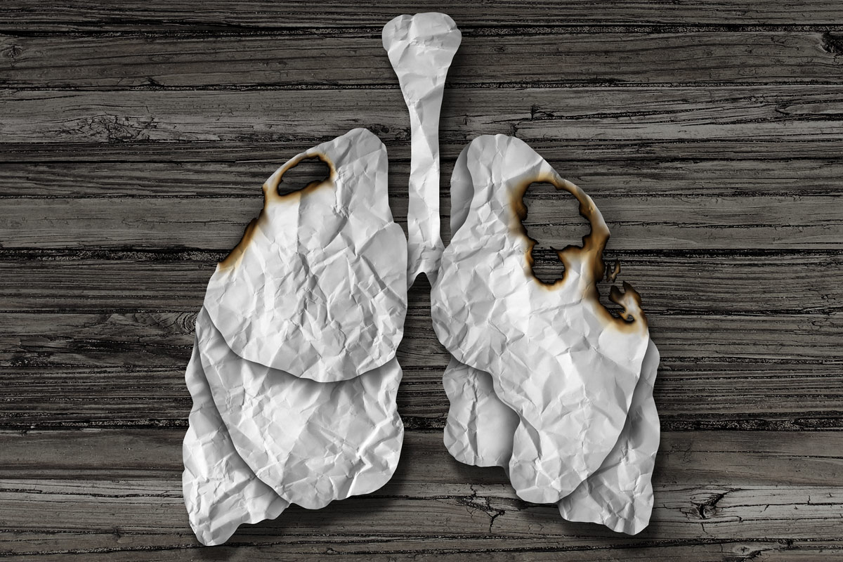 A model of a damaged lung.