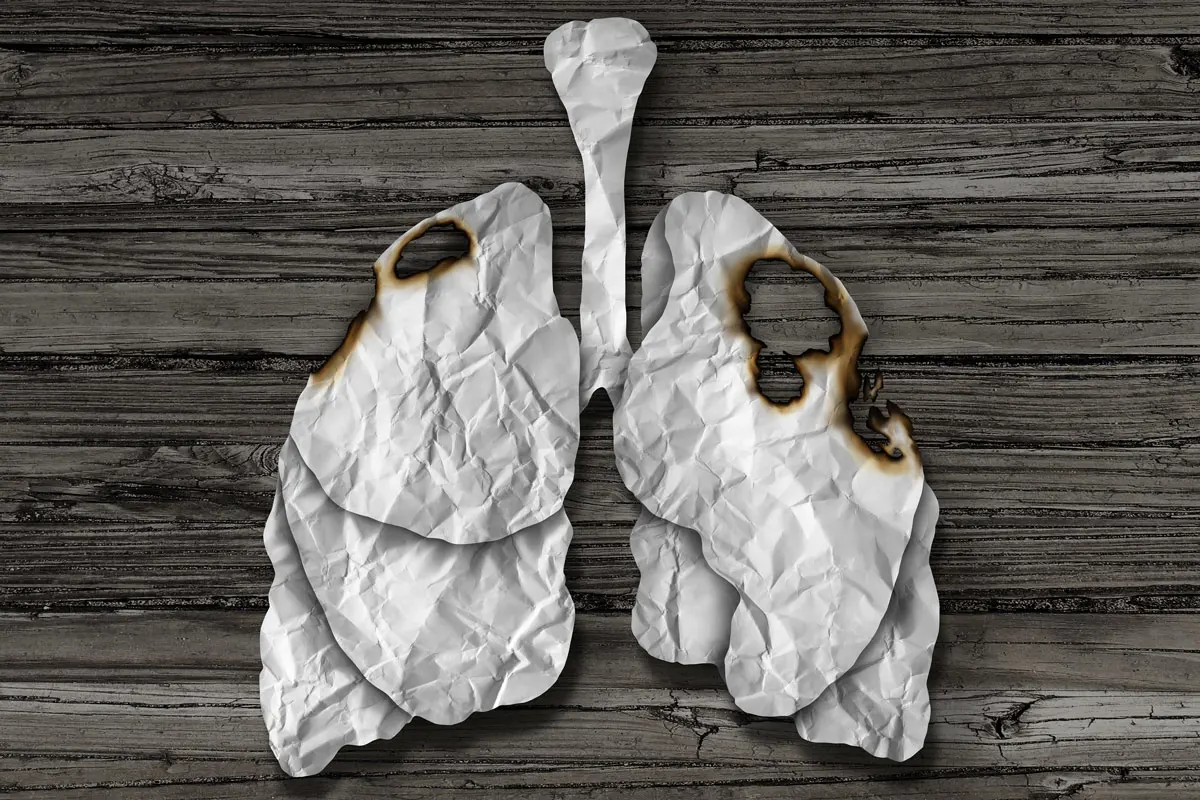 A model of a damaged lung.