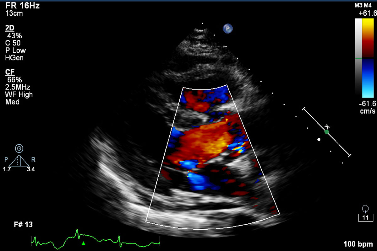 An echocardiography scan.