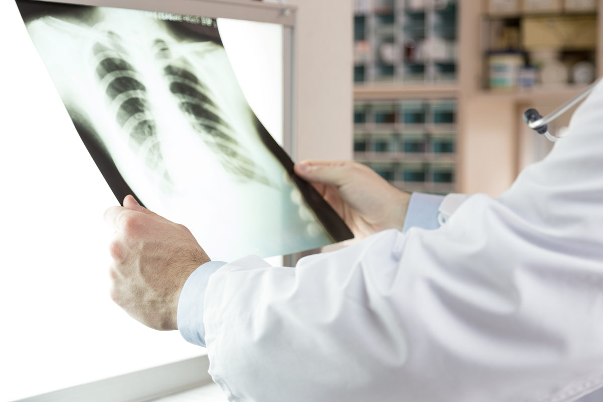 A doctor examining x-ray scans of patient.