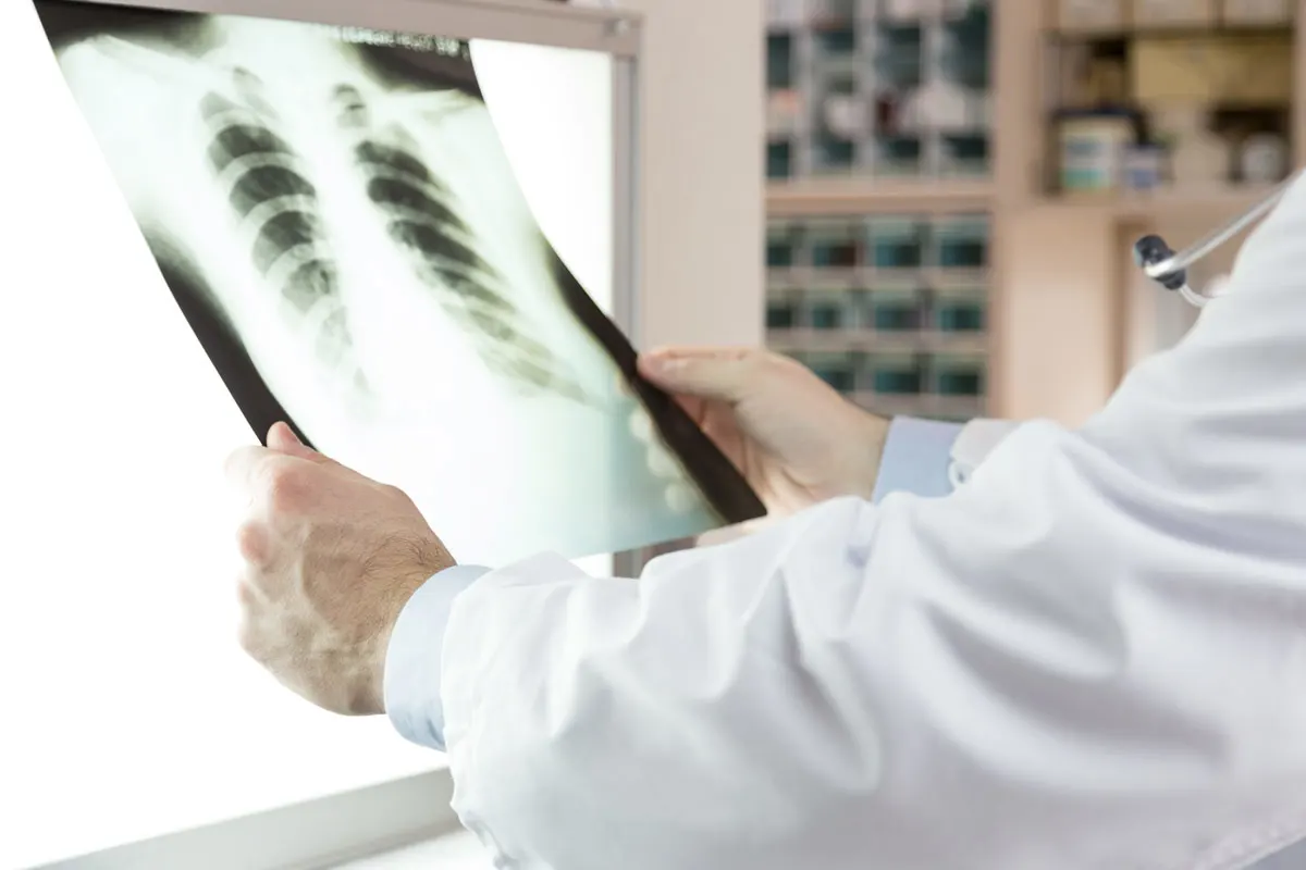 A doctor examining x-ray scans of patient.