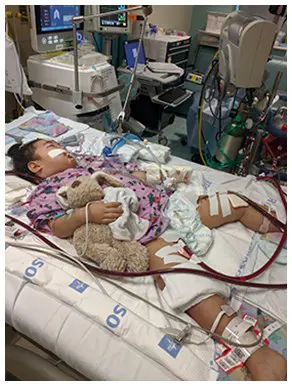 Young female patient on ECMO, a machine that pumps and oxygenates a patient's blood outside the body, allowing the heart and lungs to rest.