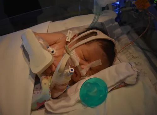 Newborn baby resting while being connected to monitors and breathing tubes. 