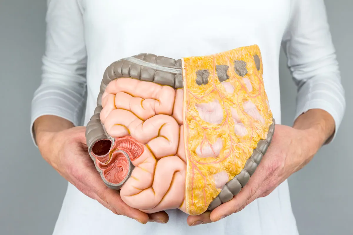 Doctor holding up a model of an intestinal tract